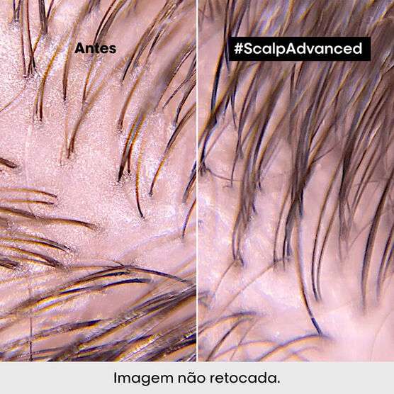 SCALP ADVANCED ANTI-OILINESS 250ML